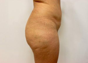 RGV Cosmetic Surgery Vein Care 