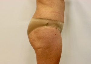 RGV Cosmetic Surgery Vein Care 