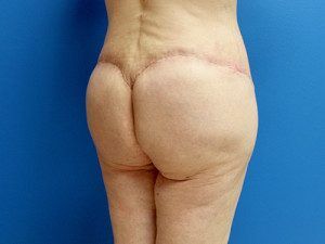 RGV Cosmetic Surgery Vein Care 