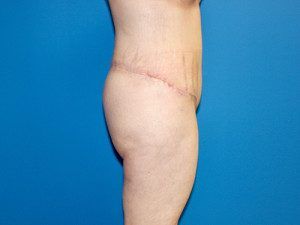 RGV Cosmetic Surgery Vein Care 
