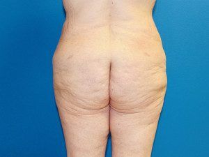 RGV Cosmetic Surgery Vein Care 