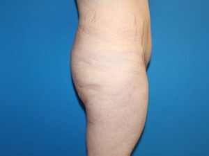 RGV Cosmetic Surgery Vein Care 