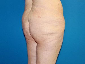 RGV Cosmetic Surgery Vein Care 