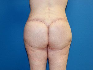 RGV Cosmetic Surgery Vein Care 