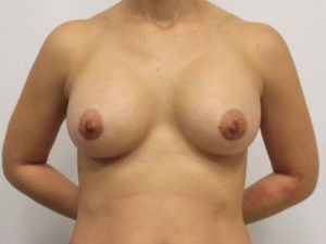 RGV Cosmetic Surgery Vein Care 