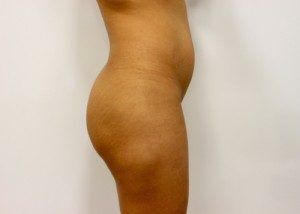 RGV Cosmetic Surgery Vein Care 