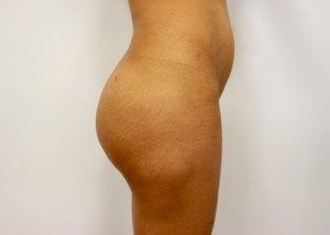 RGV Cosmetic Surgery Vein Care 
