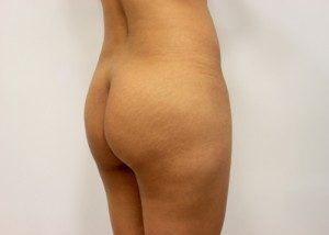 RGV Cosmetic Surgery Vein Care 