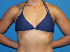 RGV Cosmetic Surgery Vein Care 