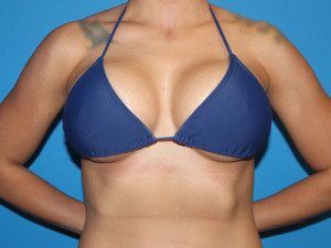 RGV Cosmetic Surgery Vein Care 