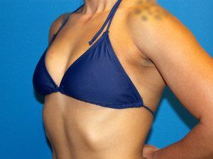 RGV Cosmetic Surgery Vein Care 