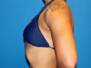 RGV Cosmetic Surgery Vein Care 