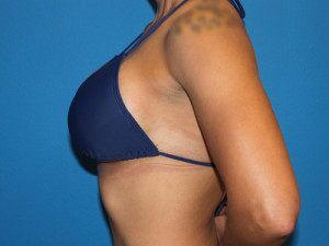 RGV Cosmetic Surgery Vein Care 