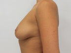 RGV Cosmetic Surgery Vein Care 