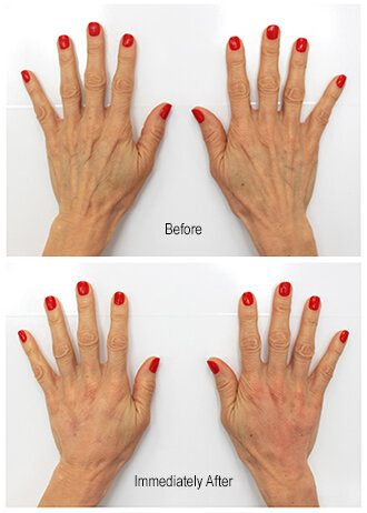 RGV Cosmetic Surgery Vein Care RGV Cosmetic Surgery Vein Care