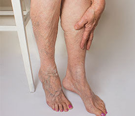 RGV Cosmetic Surgery Vein Care RGV Cosmetic Surgery Vein Care