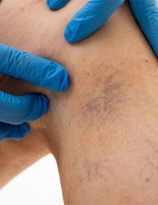 RGV Cosmetic Surgery Vein Care RGV Cosmetic Surgery Vein Care