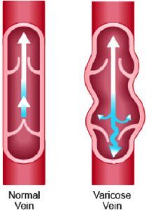 RGV Cosmetic Surgery Vein Care RGV Cosmetic Surgery Vein Care