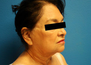 RGV Cosmetic Surgery Vein Care 