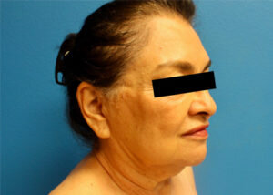 RGV Cosmetic Surgery Vein Care 