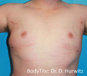 RGV Cosmetic Surgery Vein Care 