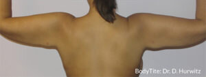 RGV Cosmetic Surgery Vein Care 
