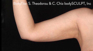 RGV Cosmetic Surgery Vein Care 