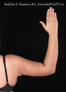 RGV Cosmetic Surgery Vein Care 