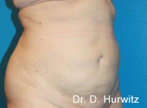 RGV Cosmetic Surgery Vein Care 