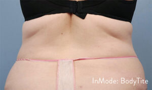 RGV Cosmetic Surgery Vein Care 