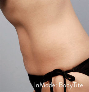RGV Cosmetic Surgery Vein Care 