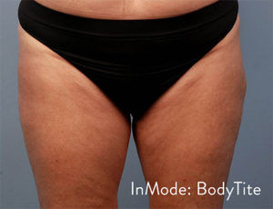 RGV Cosmetic Surgery Vein Care 