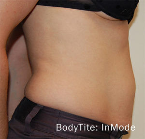 RGV Cosmetic Surgery Vein Care 