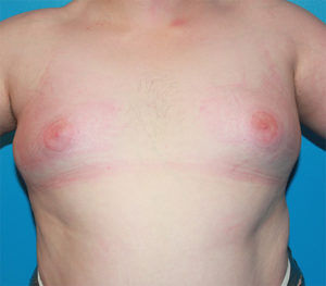 RGV Cosmetic Surgery Vein Care 