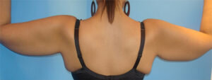 RGV Cosmetic Surgery Vein Care 