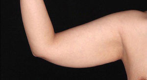 RGV Cosmetic Surgery Vein Care 