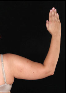 RGV Cosmetic Surgery Vein Care 