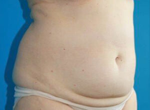 RGV Cosmetic Surgery Vein Care 