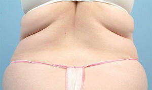 RGV Cosmetic Surgery Vein Care 