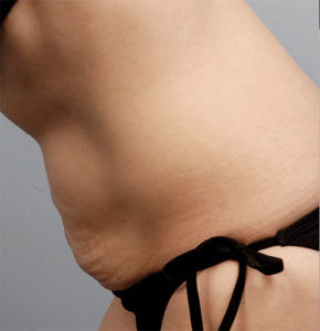 RGV Cosmetic Surgery Vein Care 