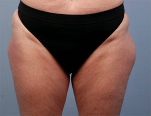 RGV Cosmetic Surgery Vein Care 