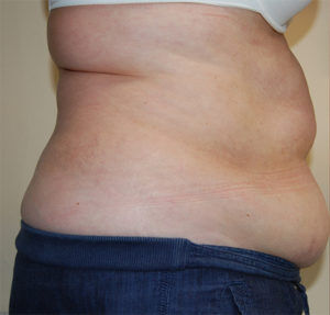 RGV Cosmetic Surgery Vein Care 