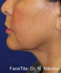 RGV Cosmetic Surgery Vein Care 