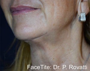 RGV Cosmetic Surgery Vein Care 