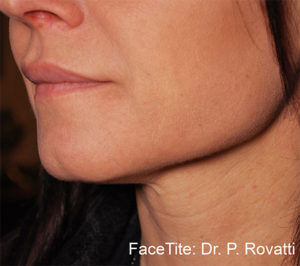 RGV Cosmetic Surgery Vein Care 