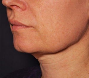 RGV Cosmetic Surgery Vein Care 