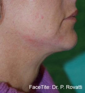 RGV Cosmetic Surgery Vein Care 