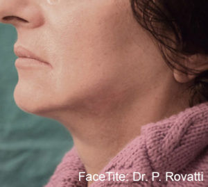 RGV Cosmetic Surgery Vein Care 