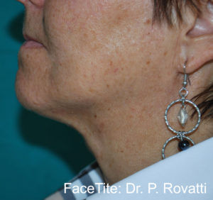 RGV Cosmetic Surgery Vein Care 
