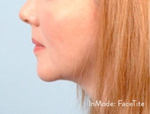 RGV Cosmetic Surgery Vein Care 
